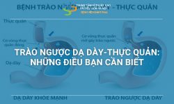 TRÀO NGƯỢC DẠ DÀY – THỰC QUẢN: NHỮNG ĐIỀU BẠN CẦN BIẾT