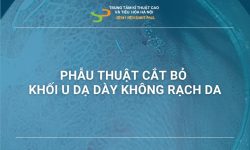 PHẪU THUẬT CẮT BỎ KHỐI U DẠ DÀY KHÔNG RẠCH DA