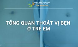 TỔNG QUAN THOÁT VỊ BẸN TRẺ EM
