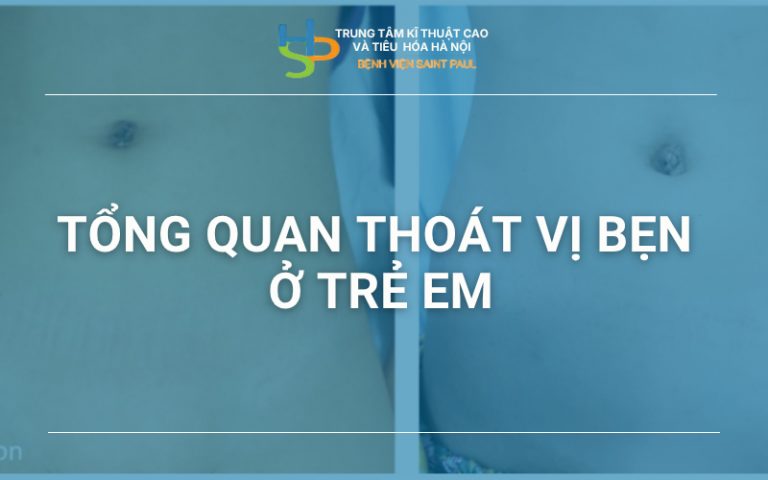 Thoát vị bẹn ở trẻ em