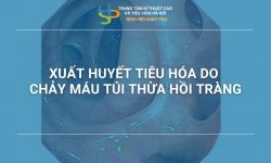 Xuất huyết tiêu hóa do chảy máu túi thừa hồi tràng