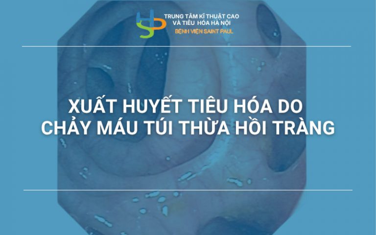 Xuất huyết tiêu hóa