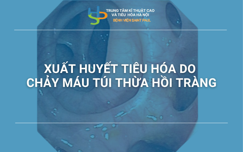 Xuất huyết tiêu hóa