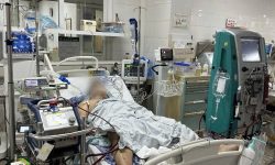 CẤP CỨU THÀNH CÔNG BỆNH NHÂN NGỪNG TUẦN HOÀN DO NHỒI MÁU CƠ TIM BẰNG ECMO