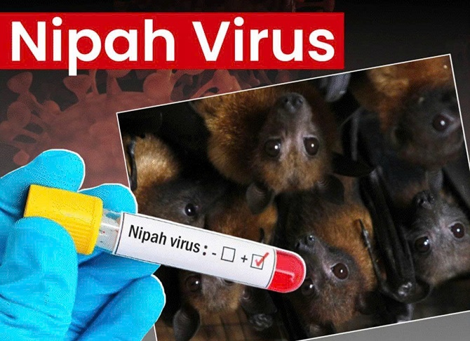 VIRUS NIPAH – CƠ CHẾ GÂY BỆNH VÀ CÁC BIỆN PHÁP PHÒNG NGỪA