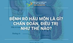 BỆNH RÒ HẬU MÔN LÀ GÌ? CHẨN ĐOÁN, ĐIỀU TRỊ NHƯ THẾ NÀO?