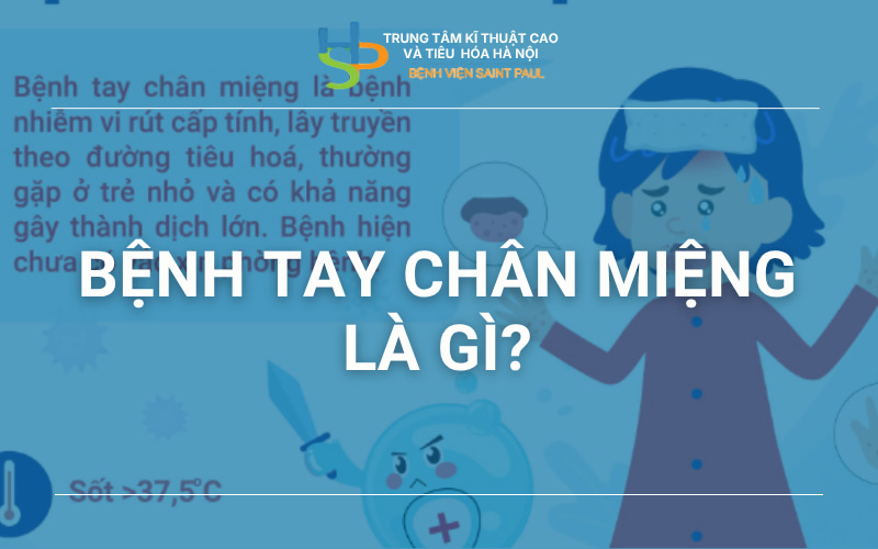 Bệnh tay chân miệng
