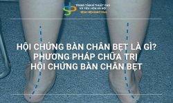HỘI CHỨNG BÀN CHÂN BẸT LÀ GÌ? PHƯƠNG PHÁP ĐIỀU TRỊ HỘI CHỨNG BÀN CHÂN BẸT