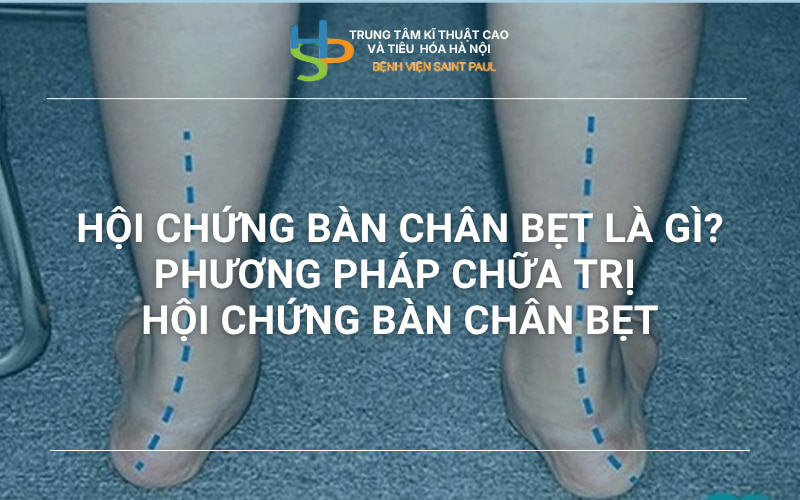 HỘI CHỨNG BÀN CHÂN BẸT LÀ GÌ? PHƯƠNG PHÁP ĐIỀU TRỊ HỘI CHỨNG BÀN CHÂN BẸT