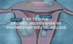 U XƠ TỬ CUNG: DẤU HIỆU, NGUYÊN NHÂN VÀ PHƯƠNG PHÁP ĐIỀU TRỊ HIỆU QUẢ