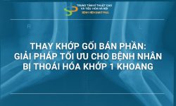 THAY KHỚP GỐI BÁN PHẦN – GIẢI PHÁP TỐI ƯU CHO BỆNH  NHÂN BỊ THOÁI HÓA KHỚP 1 KHOANG