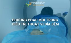 PHƯƠNG PHÁP MỚI TRONG ĐIỀU TRỊ THOÁT VỊ ĐĨA ĐỆM