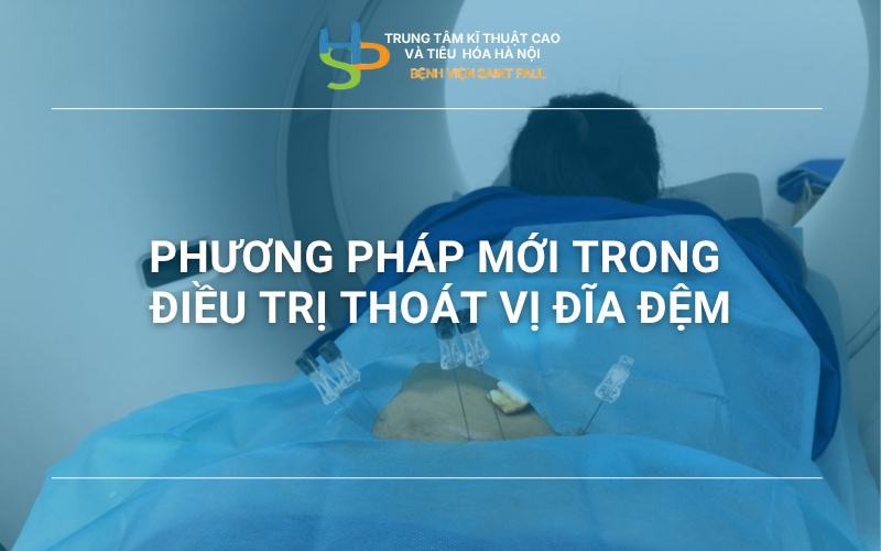 PHƯƠNG PHÁP MỚI TRONG ĐIỀU TRỊ THOÁT VỊ ĐĨA ĐỆM