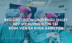 BÁO CÁO TRƯỜNG HỢP PHẪU THUẬT NẸP VÍT XƯƠNG SƯỜN TẠI BỆNH VIỆN ĐA KHOA XANH PÔN