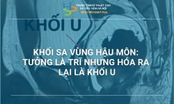 KHỐI SA VÙNG HẬU MÔN: TƯỞNG LÀ TRĨ NHƯNG HÓA RA LẠI LÀ KHỐI U