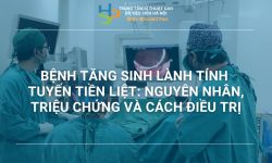BỆNH TĂNG SINH LÀNH TÍNH TUYẾN TIỀN LIỆT: NGUYÊN NHÂN, TRIỆU CHỨNG VÀ CÁCH ĐIỀU TRỊ