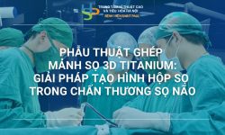 PHẪU THUẬT GHÉP MẢNH SỌ 3D TITANIUM: GIẢI PHÁP TẠO HÌNH HỘP SỌ TRONG CHẤN THƯƠNG SỌ NÃO
