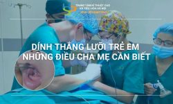 DÍNH THẮNG LƯỠI TRẺ EM NHỮNG ĐIỀU CHA MẸ CẦN BIẾT