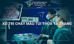 XỬ TRÍ CHẢY MÁU TÚI THỪA TÁ TRÀNG