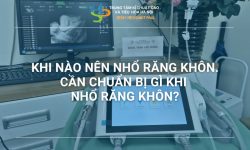 KHI NÀO NÊN NHỔ RĂNG KHÔN? CẦN CHUẨN BỊ GÌ TRƯỚC KHI NHỔ RĂNG KHÔN