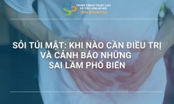 SỎI TÚI MẬT: KHI NÀO CẦN ĐIỀU TRỊ VÀ CẢNH BÁO NHỮNG SAI LẦM PHỔ BIẾN