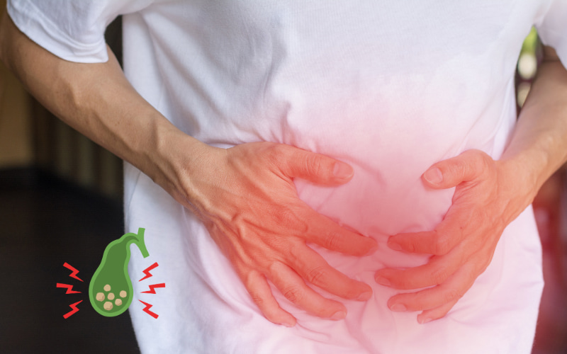 Sỏi Túi Mật