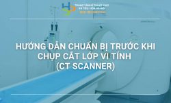 HƯỚNG DẪN CHUẨN BỊ TRƯỚC KHI CHỤP CẮT LỚP VI TÍNH (CT SCANNER)