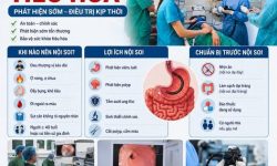 NỘI SOI TIÊU HÓA – ĐỪNG ĐỢI ĐAU MỚI ĐI KHÁM!