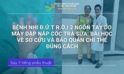 BỆNH NHI Đ.Ứ.T R.Ờ.I 2 NGÓN TAY DO MÁY DẬP NẮP CỐC TRÀ SỮA: BÀI HỌC VỀ SƠ CỨU VÀ BẢO QUẢN CHI THỂ ĐÚNG CÁCH