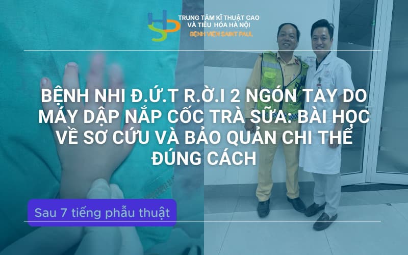 BỆNH NHI Đ.Ứ.T R.Ờ.I 2 NGÓN TAY DO MÁY DẬP NẮP CỐC TRÀ SỮA: BÀI HỌC VỀ SƠ CỨU VÀ BẢO QUẢN CHI THỂ ĐÚNG CÁCH