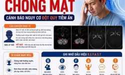 ĐỪNG CHỦ QUAN VỚI CƠN CHÓNG MẶT: CẢNH BÁO NGUY CƠ ĐỘT QUỴ TIỀM ẨN