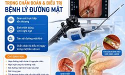SPYGLASS – BƯỚC TIẾN MỚI TRONG CHẨN ĐOÁN VÀ ĐIỀU TRỊ BỆNH LÝ ĐƯỜNG MẬT BẰNG NỘI SOI MẬT TỤY NGƯỢC DÒNG (ERCP)