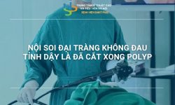 NỘI SOI ĐẠI TRÀNG KHÔNG ĐAU – TỈNH DẬY LÀ ĐÃ CẮT XONG POLYP